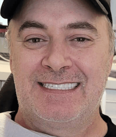 After treatment — A Refreshed Smile