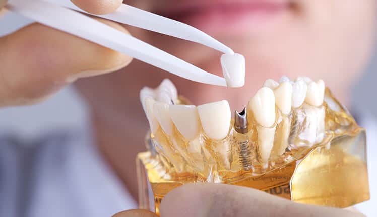 Interior of Acacia Dental in Tempe for dental implants care