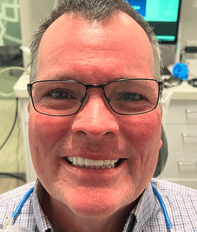 After treatment — Restoring a Confident Smile