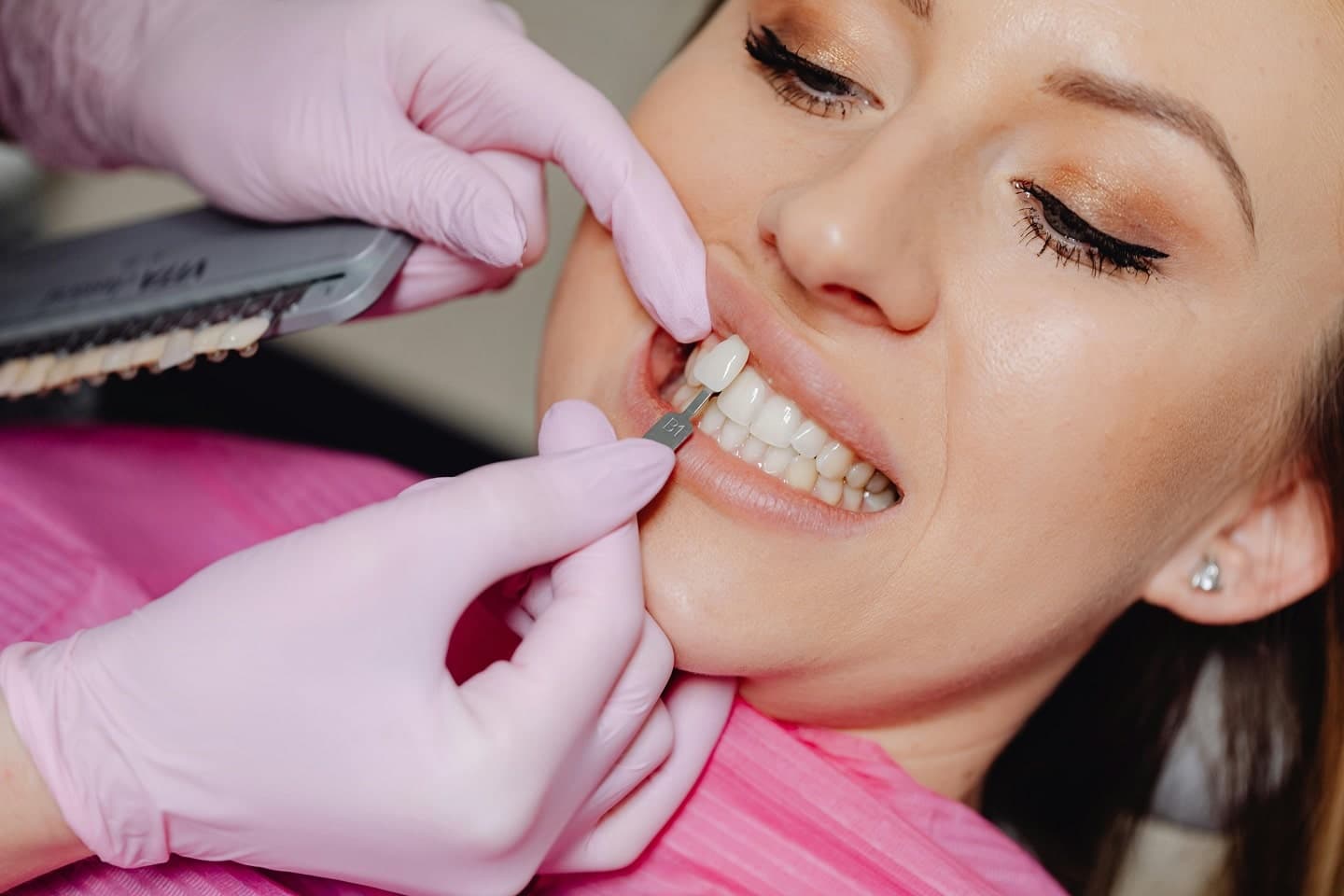 Understanding the Veneer Procedure: A Guide