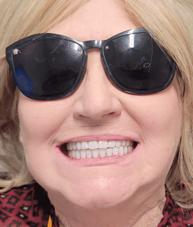 After treatment — A Brighter, Fuller Smile