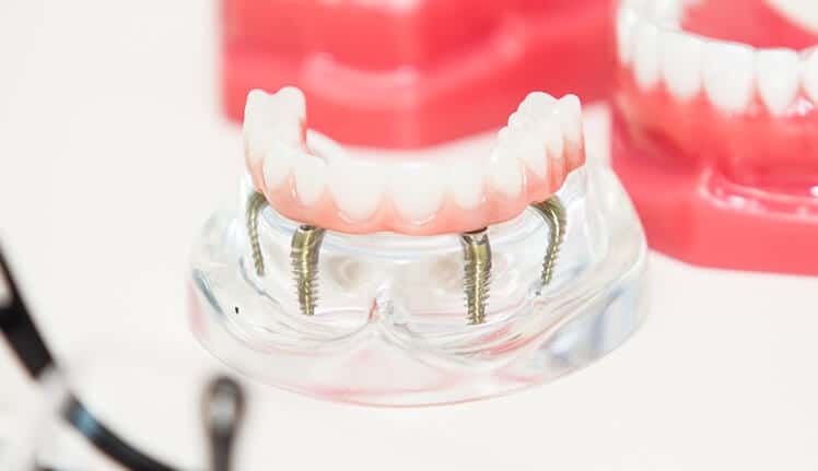 Interior of Acacia Dental in Tempe for all-on-4 dental implants care