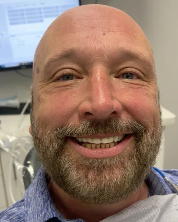 Acacia Dental patient smiling after treatment