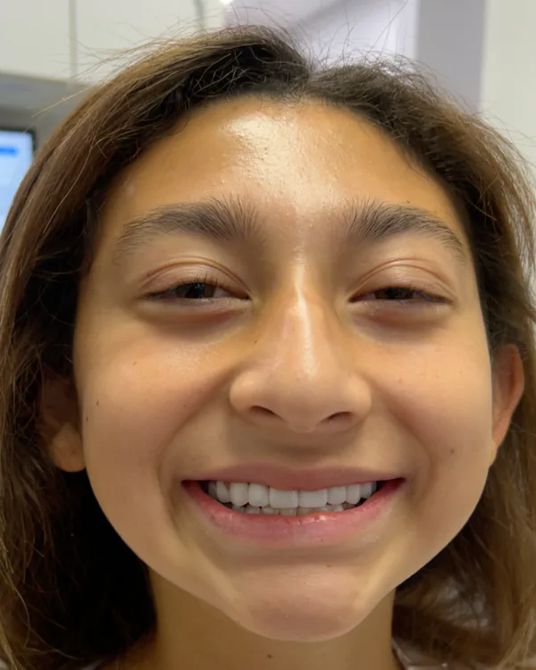 Acacia Dental patient showing her smile after treatment