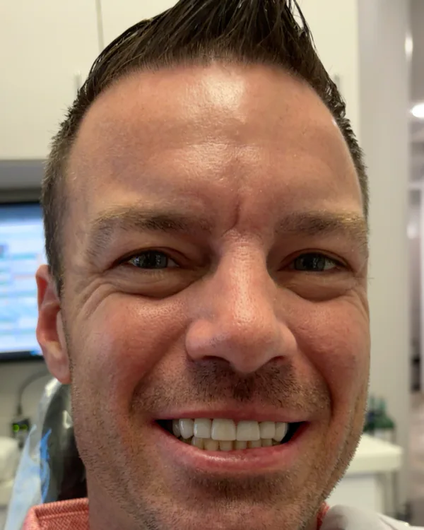 Acacia Dental patient showing his smile after treatment