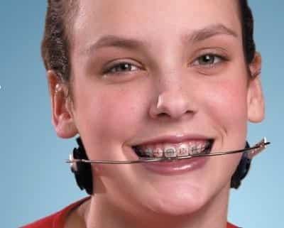 Young woman with braces