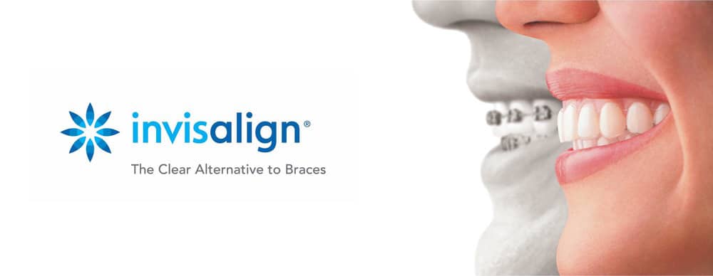 Invisalign logo