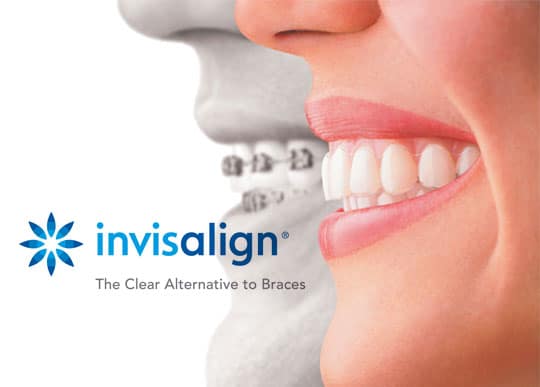 Invisalign logo