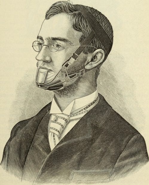 Textbook sketch of a man wearing old-fashioned orthodontic headgear to straighten his smile and move his jaw