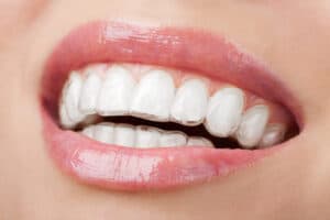 Mastering Invisalign: Tips for a Successful Treatment