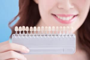 Transforming Smiles: Your Journey to Porcelain Veneers
