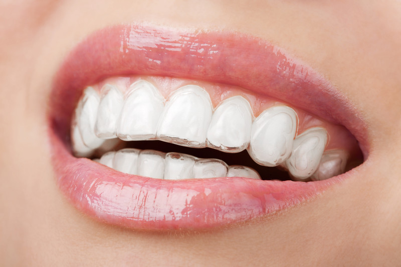 canstockphoto9221908